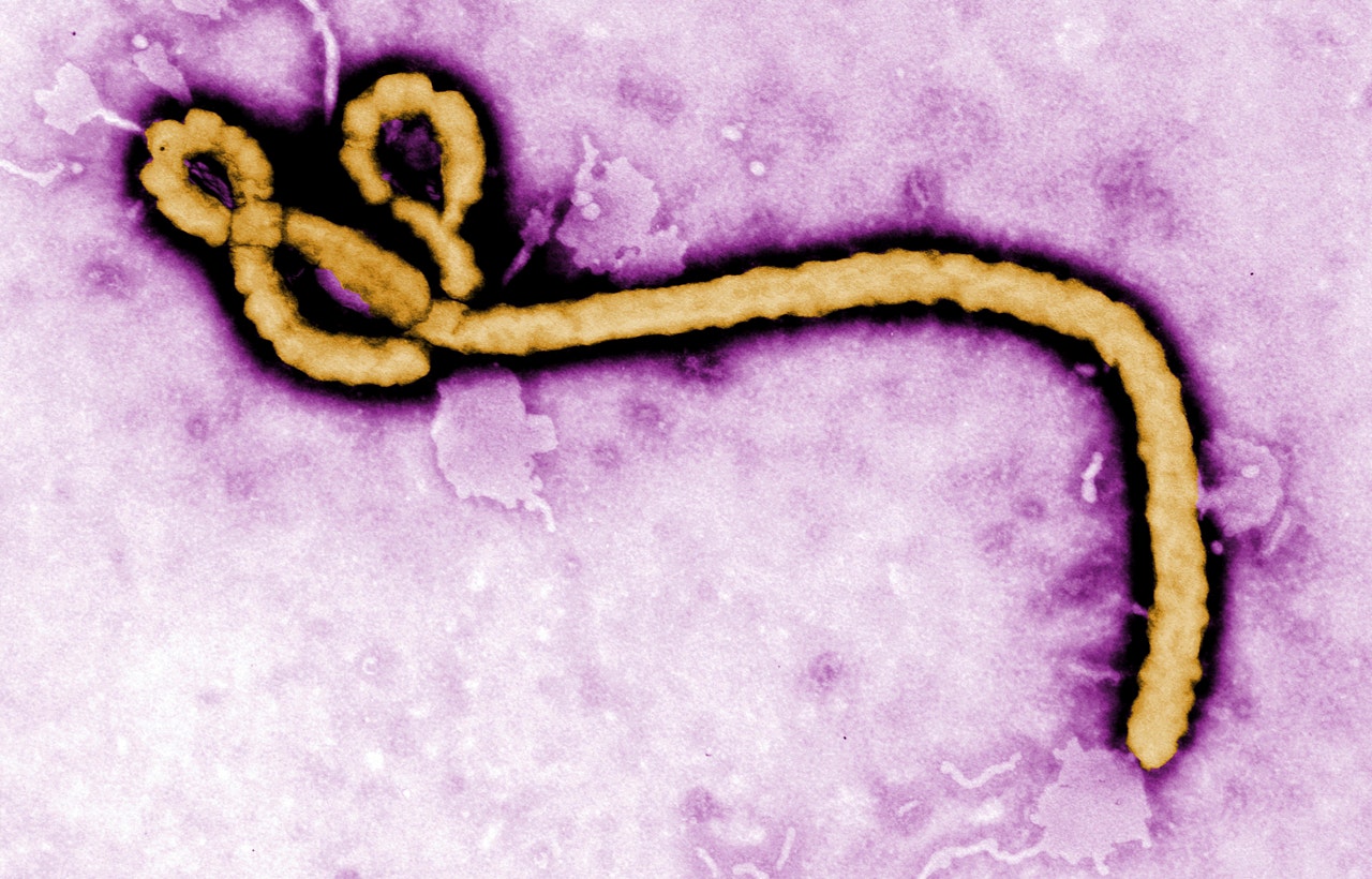 Travelers entering US from Uganda to be screened for Ebola