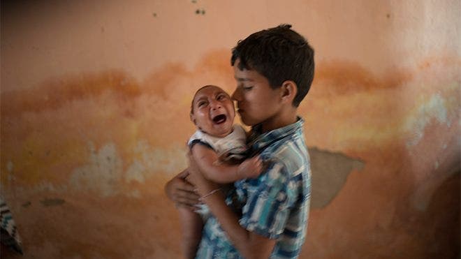 Brazil hit by Zika, a mysterious rash of babies born with small heads