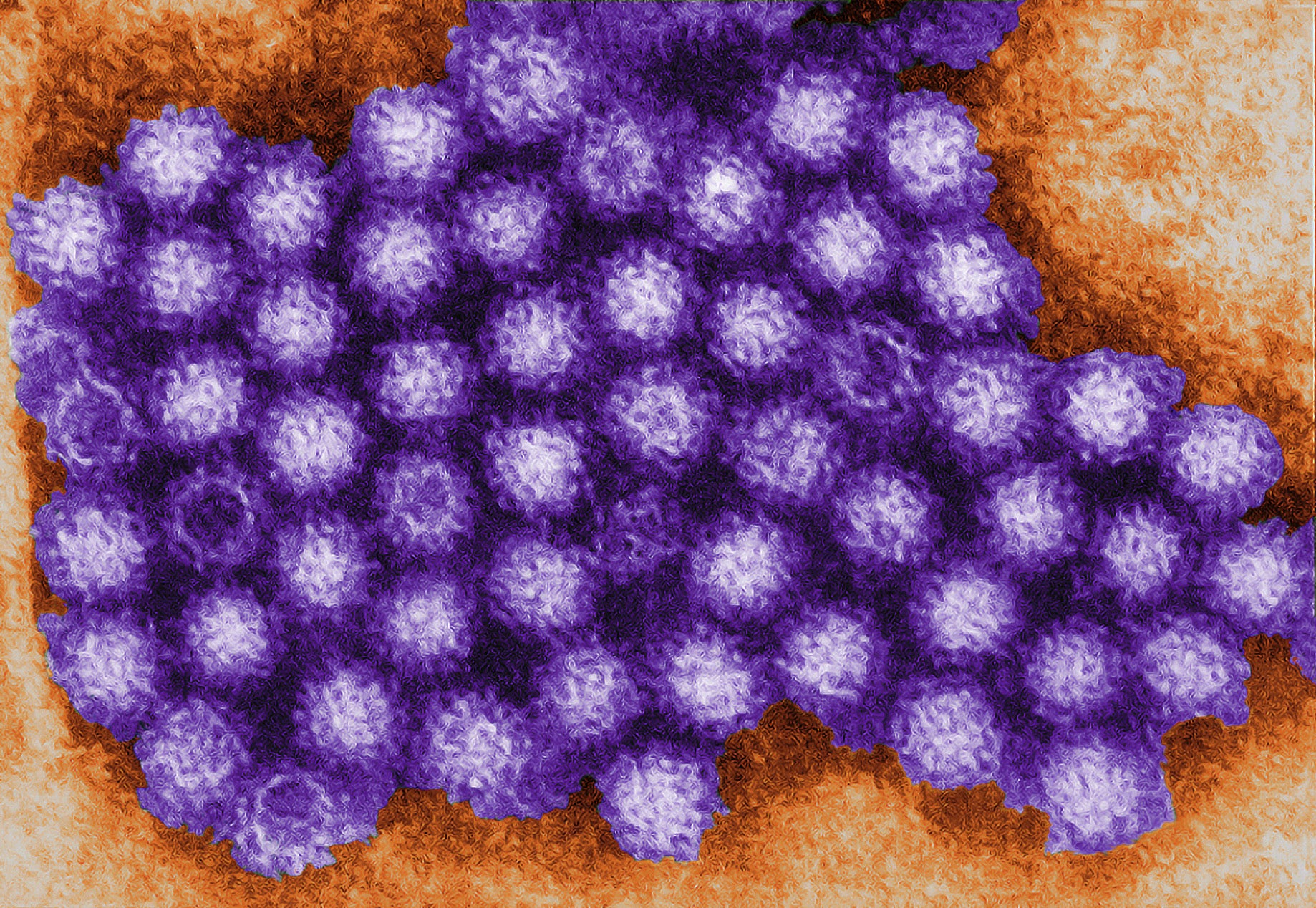 Forget COVID; CDC now warns this virus is highly contagious
