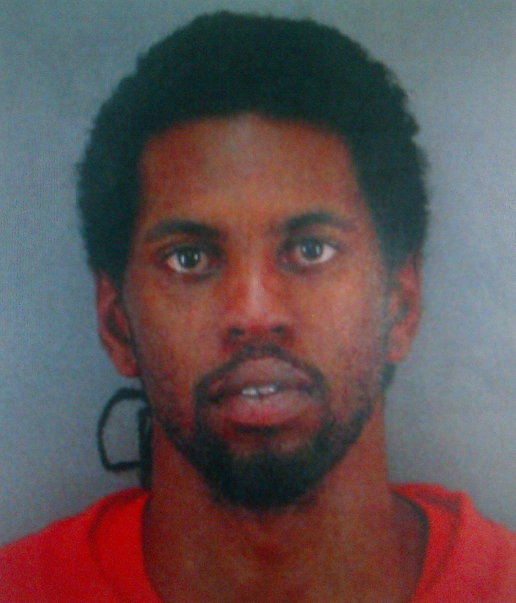 San Francisco police search for man who set girlfriend on fire | Fox News