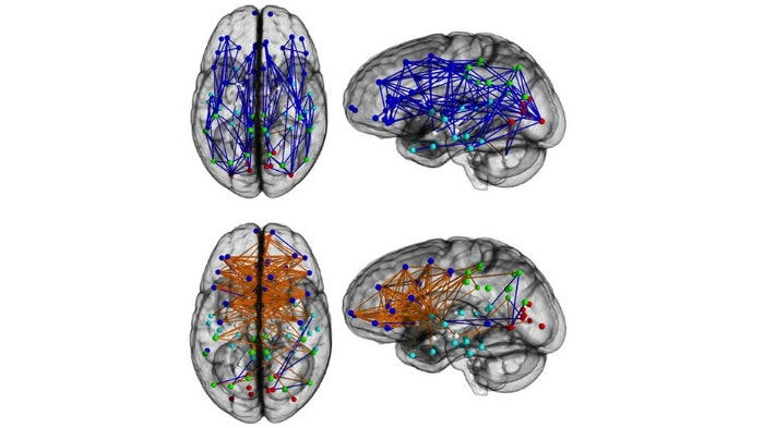 How Mens Brains Are Wired Differently Than Womens Fox News