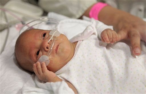 Как выглядит восьмимесячный ребенок Palm-Sized Baby, 2nd Smallest in U.S., to be Released From Hospital by New Year'