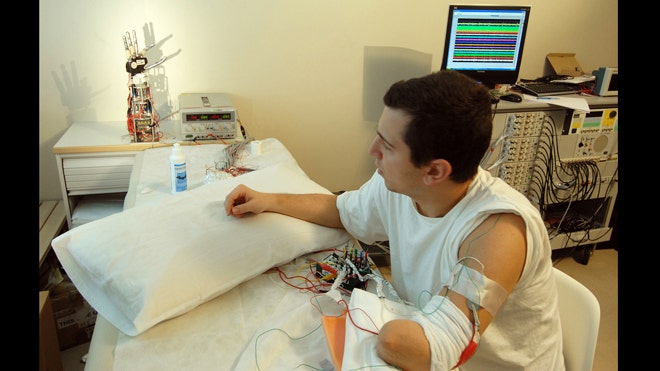 New bionic hand may let amputees feel again