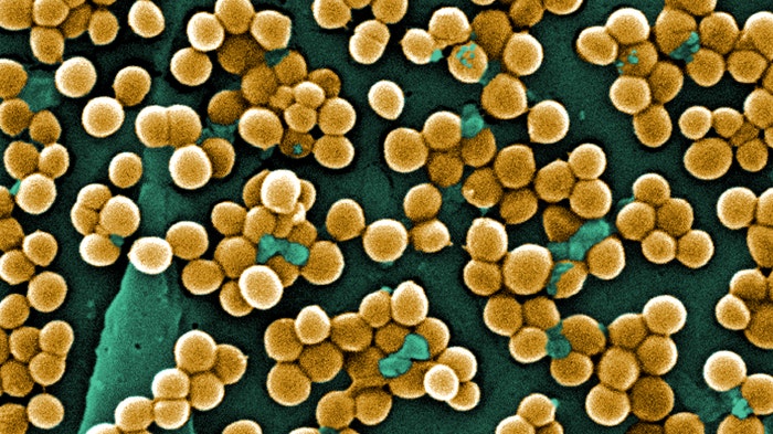 Hospital-acquired MRSA infection rates falling, CDC says | Fox News