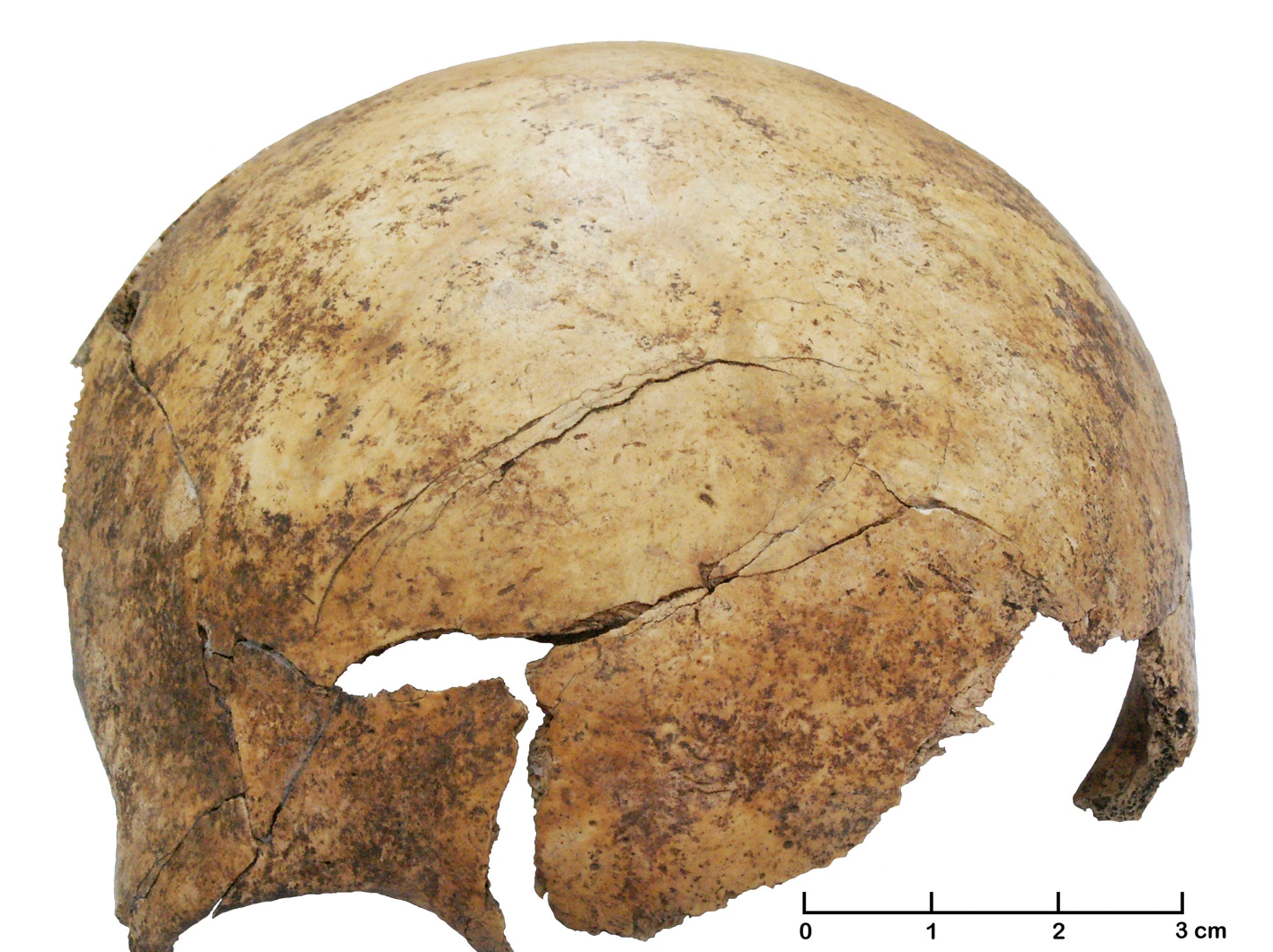 Old bone. Люди времен неолита форма черепа.