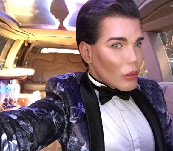 'Human Ken Doll' hospitalized for infection that's caused hole in his ...