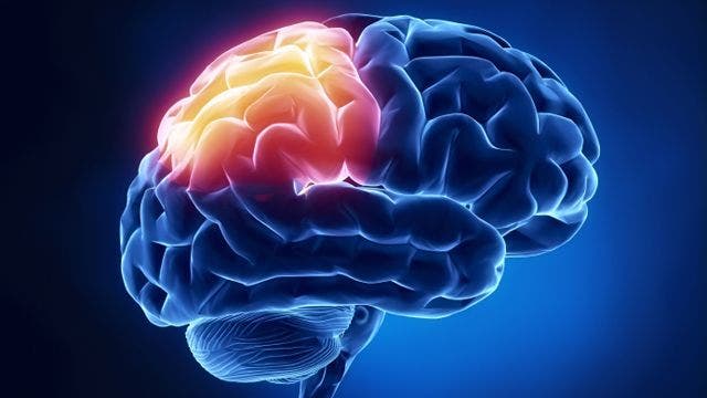 Brain Activity Of Sex Addicts Similar To That Of Drug Addicts Fox News 