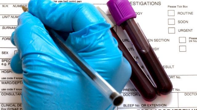 Simple blood test could detect cancers