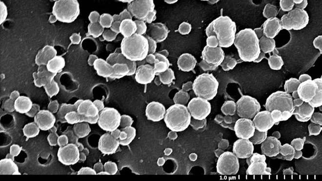 Ancient microbes found in buried Antarctic lake