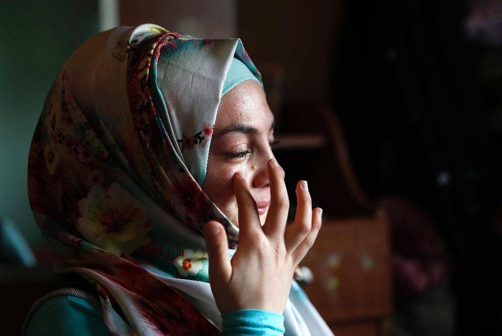 4 tahun kemudian, bekas luka di wajah gadis perang Suriah