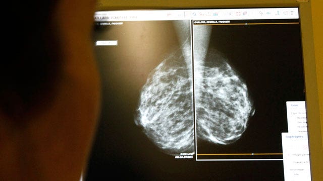 Atypical hyperplasia bigger breast cancer risk factor than previously ...