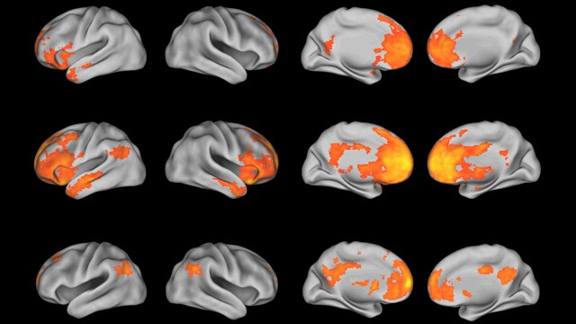 Is Your Brain Liberal Or Conservative? | Fox News