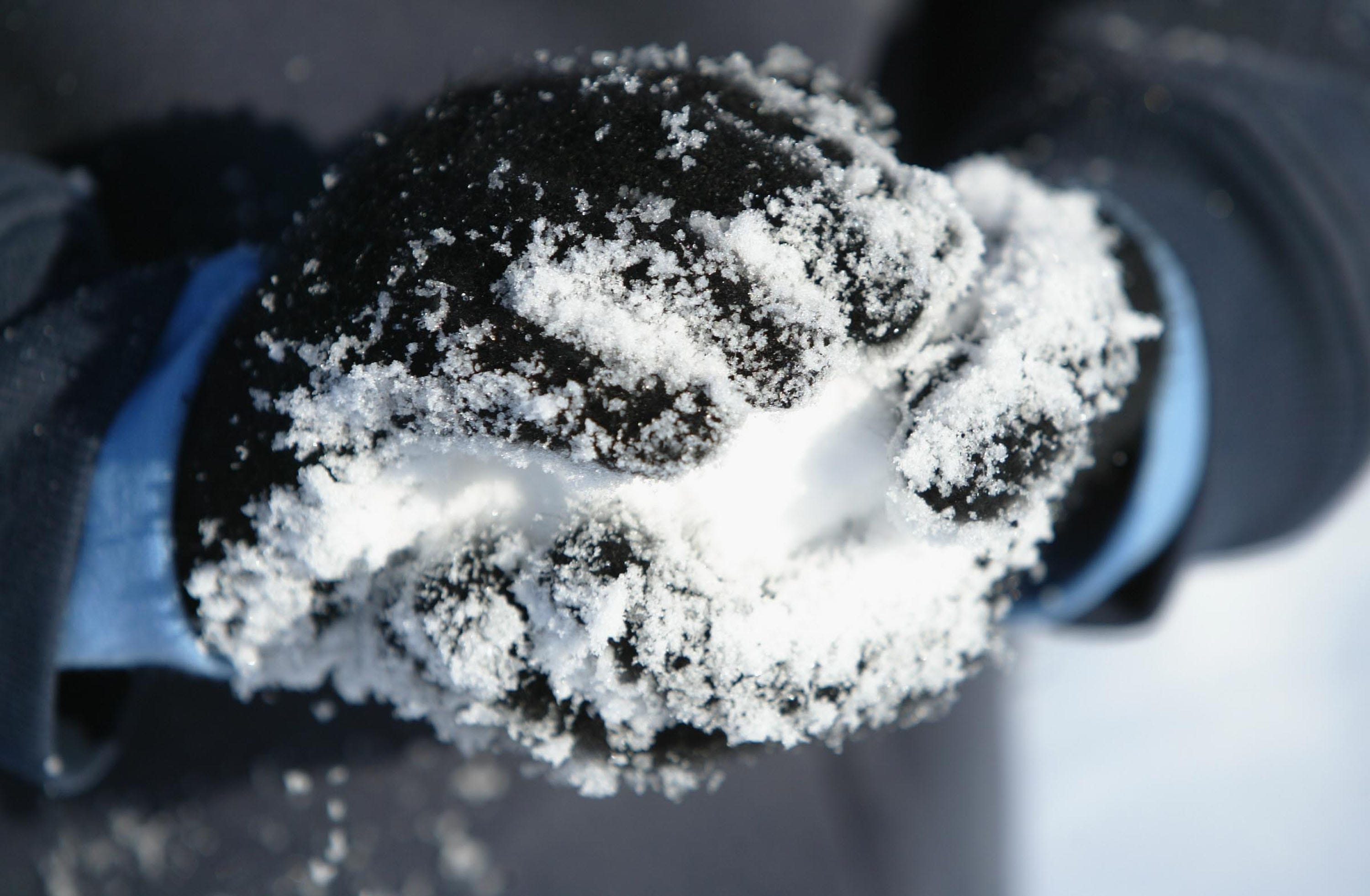 how to get rid of swelling in hands and feet in winter