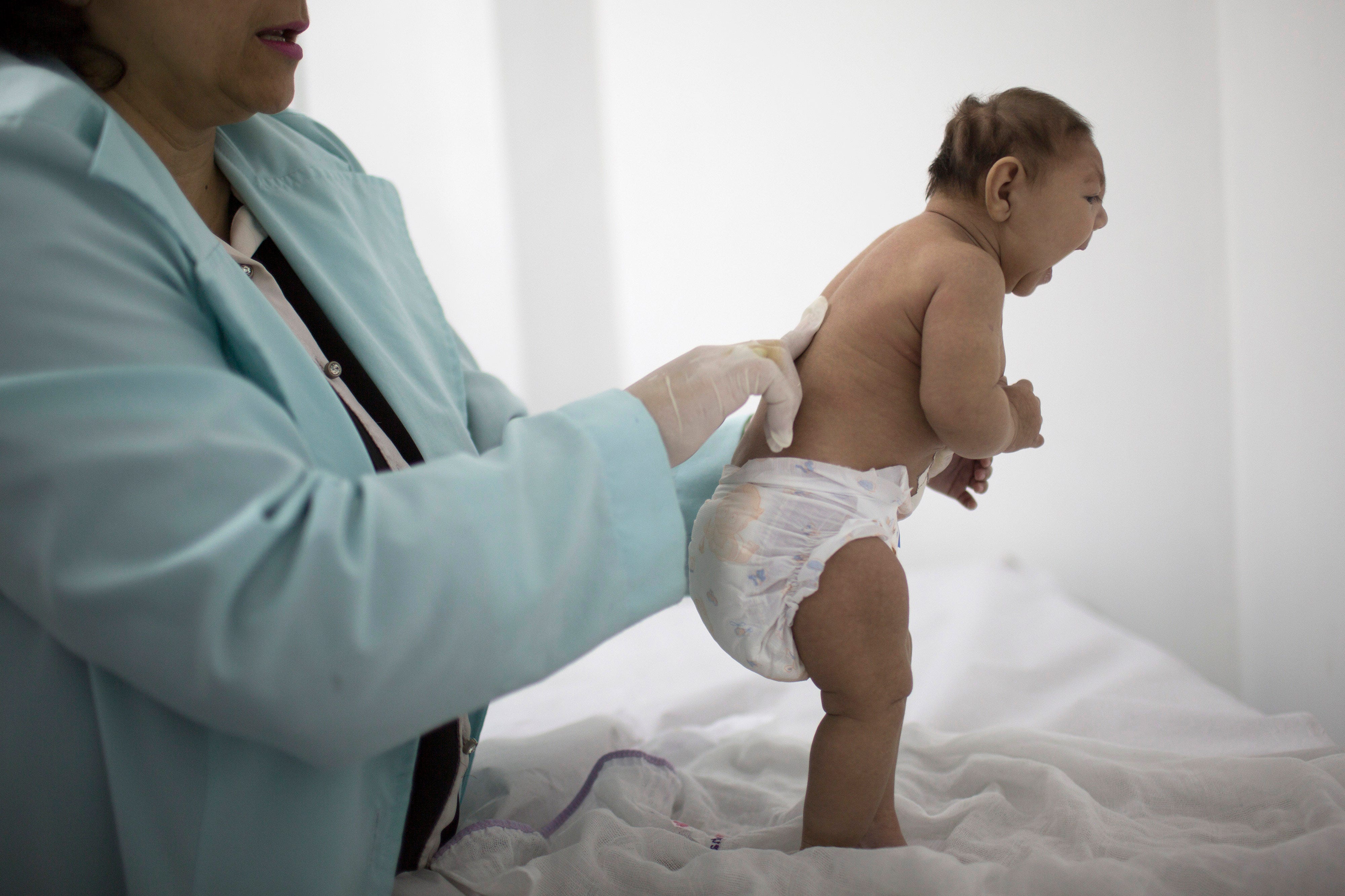 Cdc Says It S Now Clear That Zika Virus Causes Microcephaly Fox News