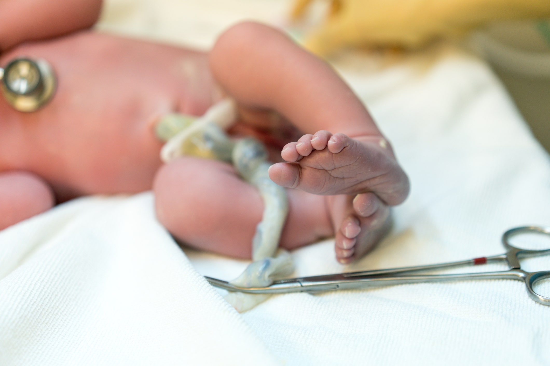 Delay in clamping umbilical cord benefits babies, U.S. doctors say