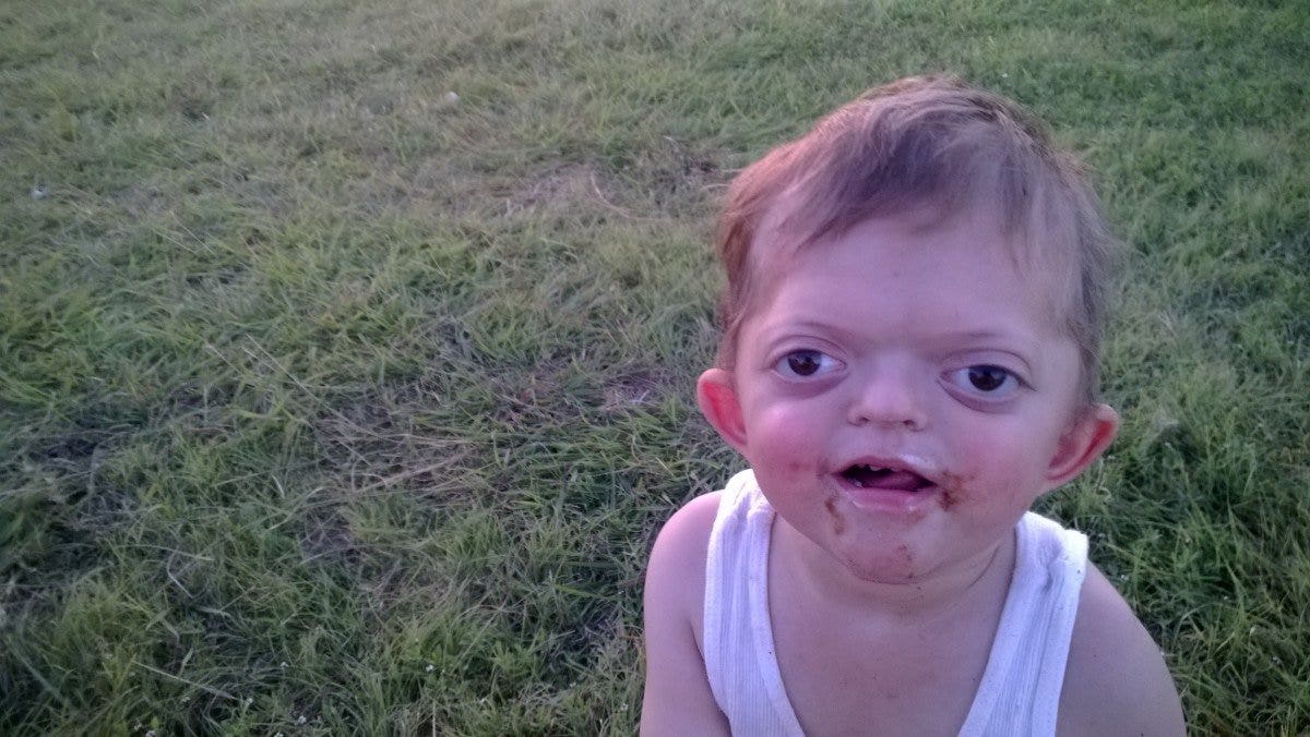 Mom Hits Back At Trolls Who Turned Disabled Sons Photo Into Internet Meme Fox News 9998