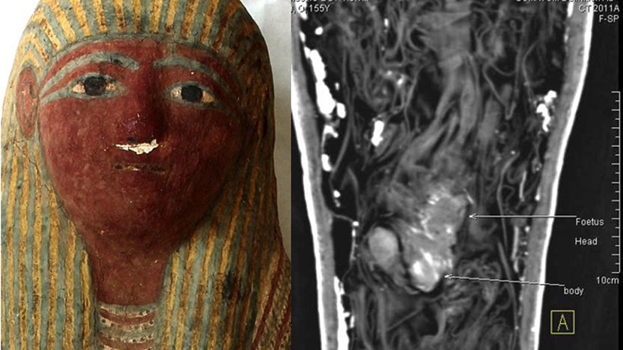 Mummified fetus found in tiny ancient Egyptian sarcophagus