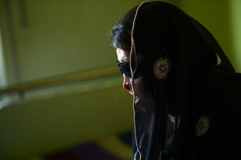 Pakistani actress burned in acid attack | Fox News