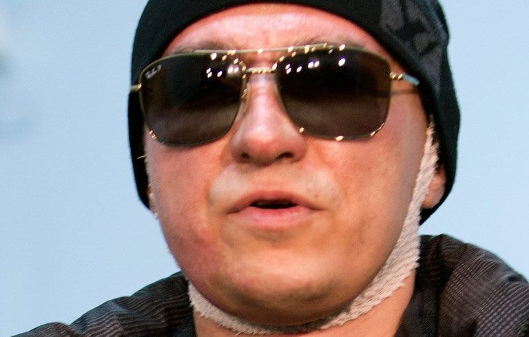 Сергей филин фото до и после операции