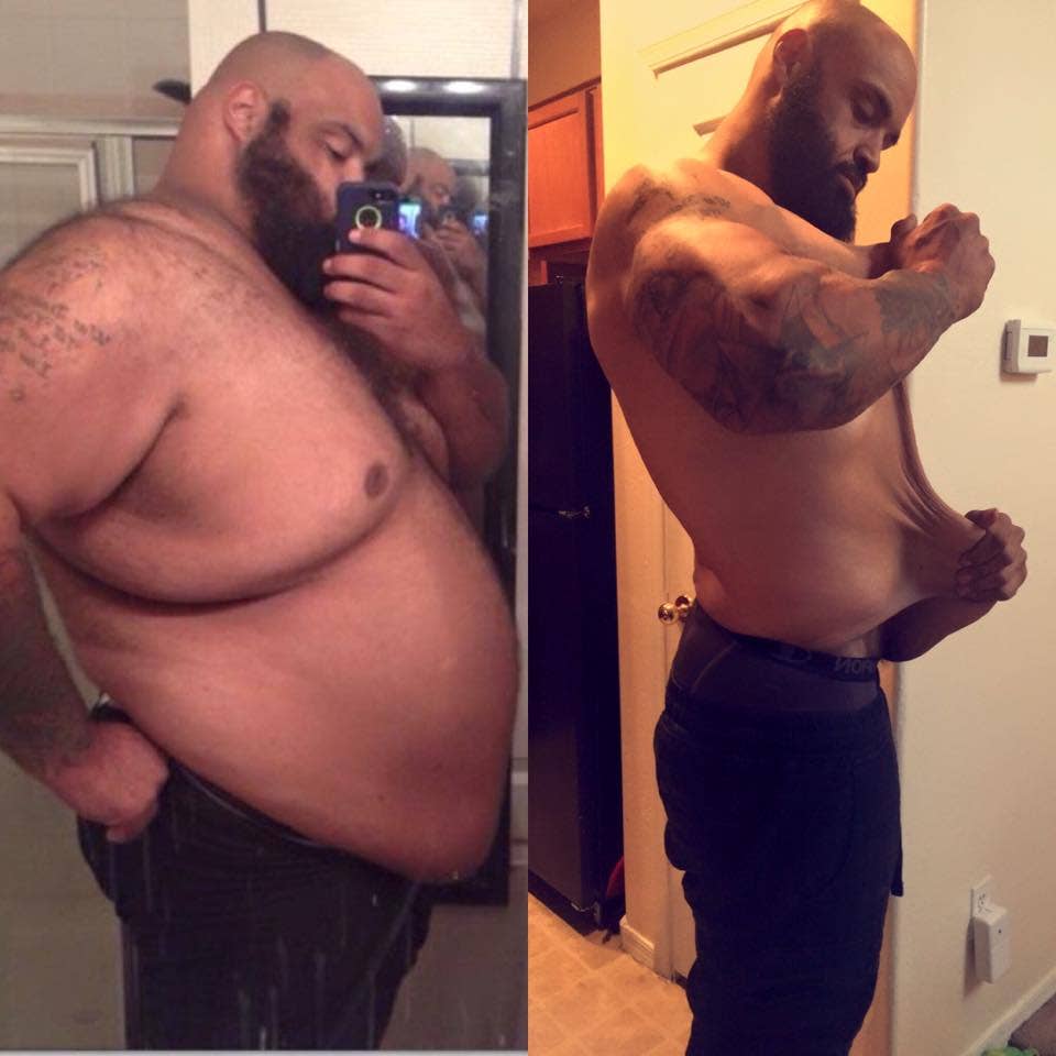Arizona man who lost over 300 pounds fundraises for skin surgery