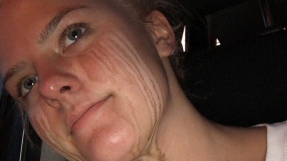 Teens Post Spray Tan Selfie Goes Viral