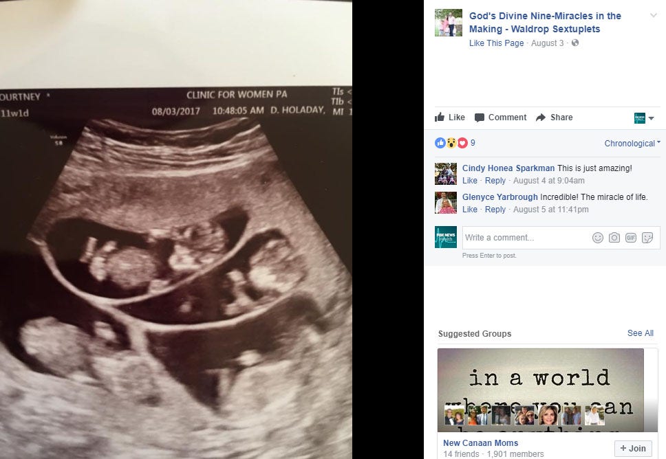 Mom Of 3 Shocked To Learn Shes Expecting Sextuplets Fox News
