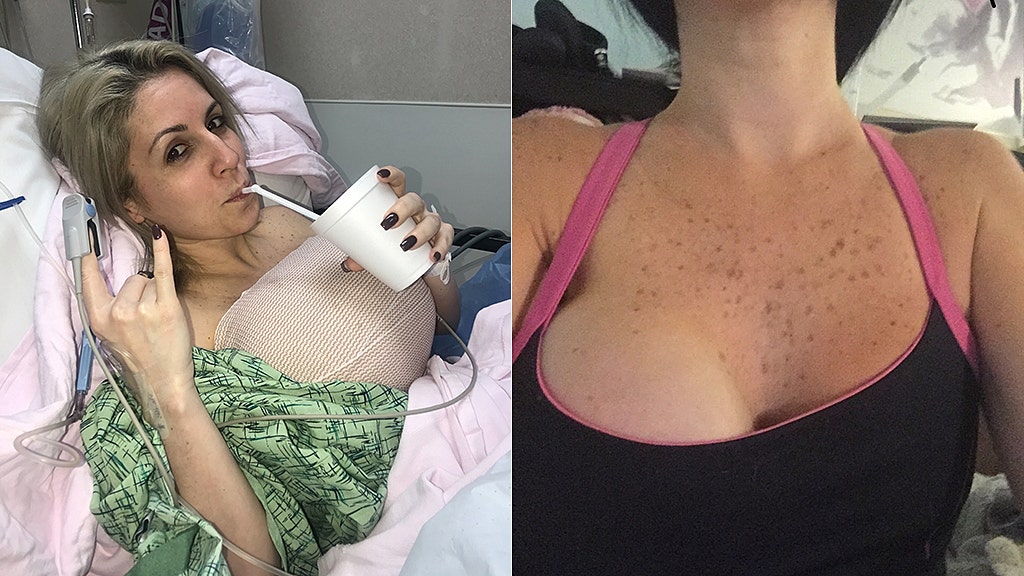 Woman had left breast removed after contracting sepsis in implant