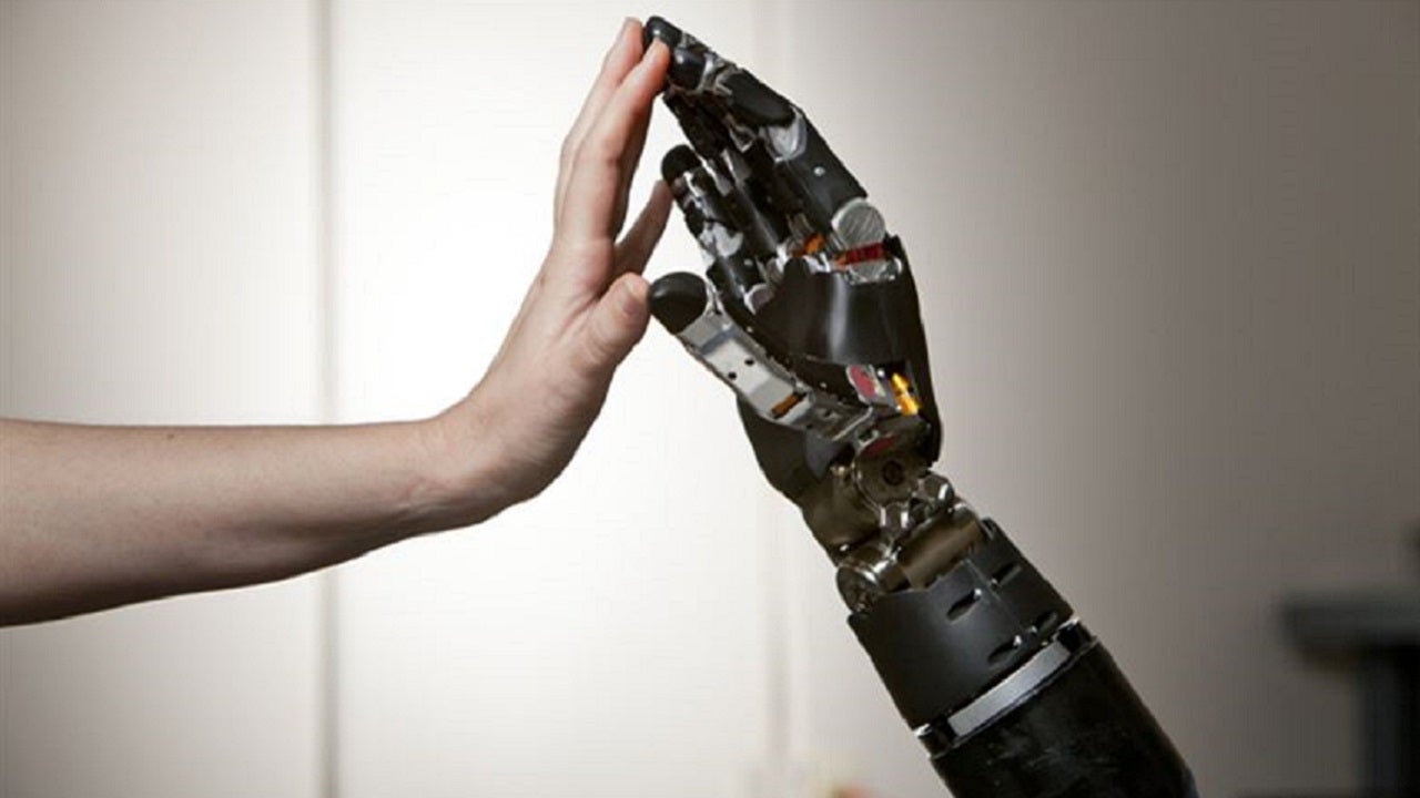 Первая бионическая рука 1993