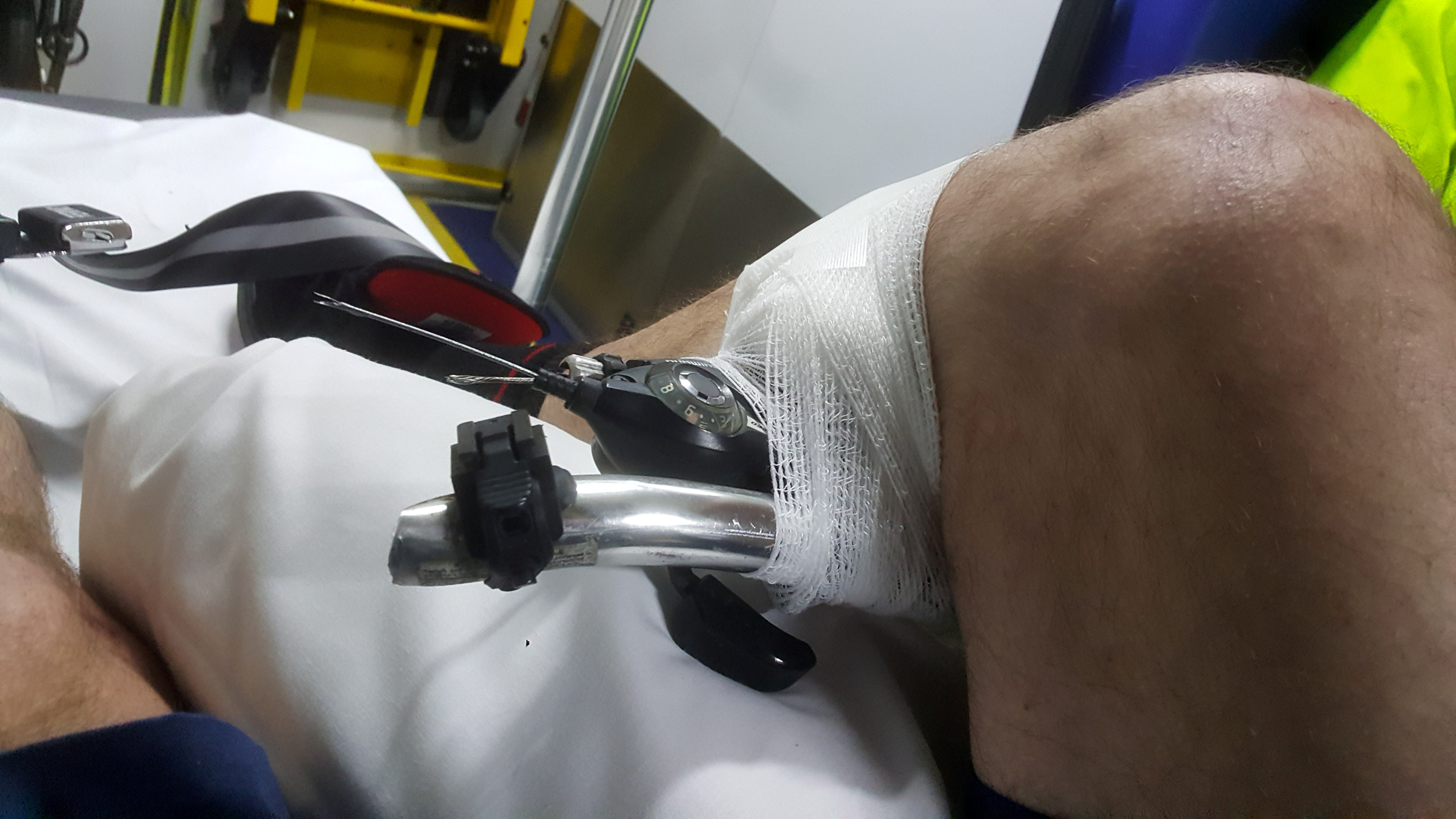 Man impaled by bike’s handlebars says accident ‘happened so fast’