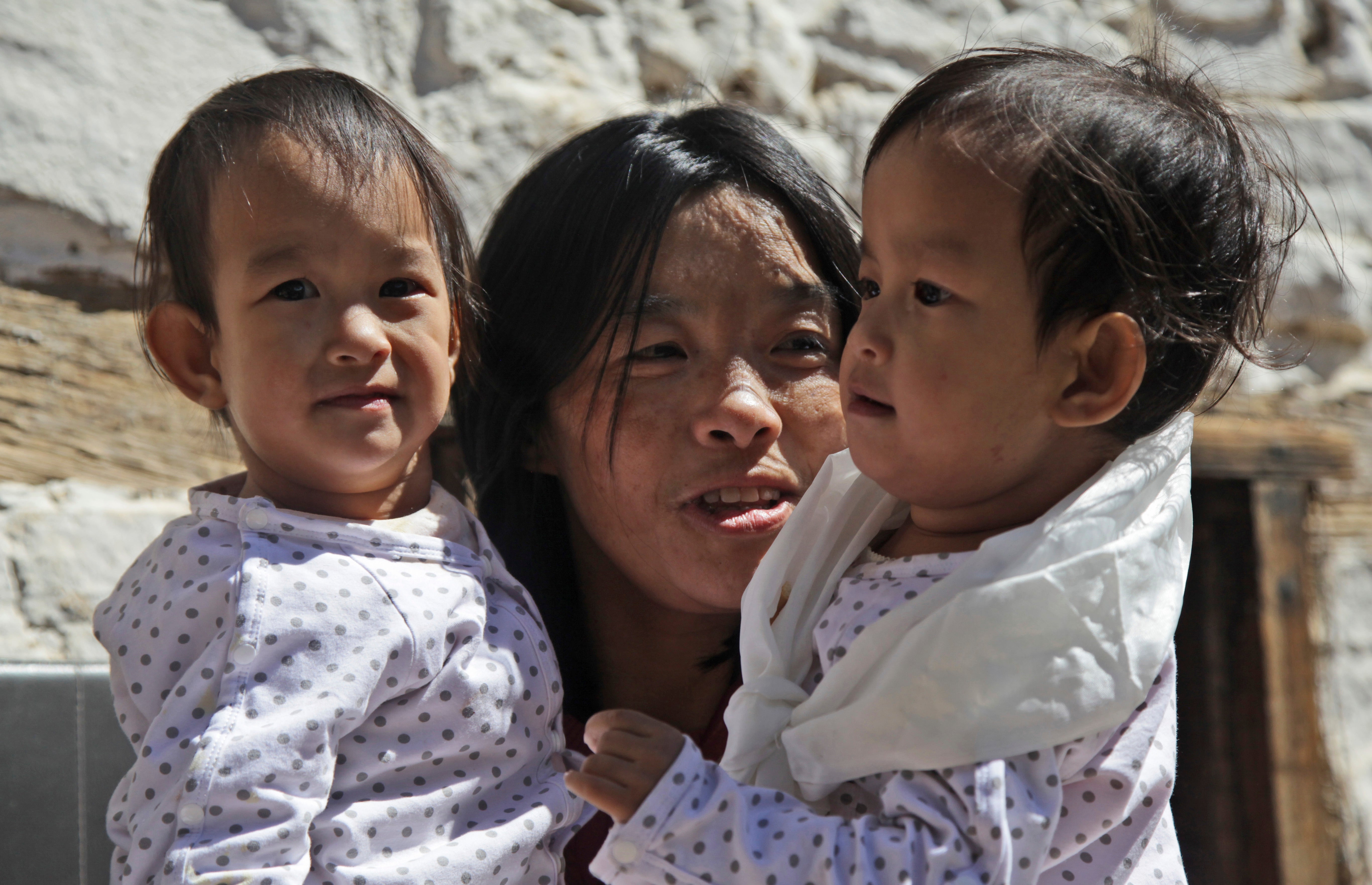 Conjoined Twins Back In Bhutan After Separation In Australia Trendolbiz