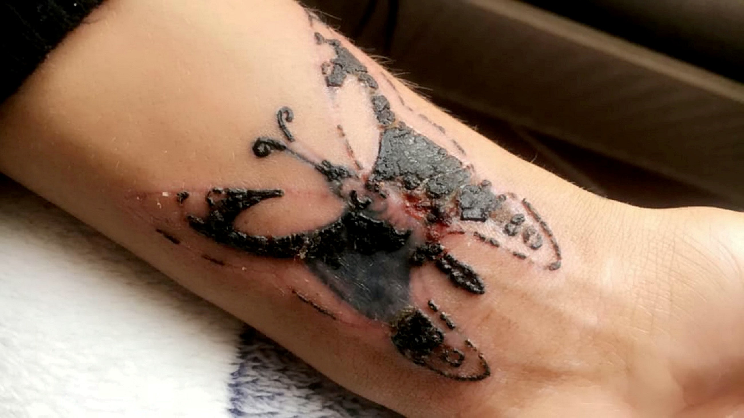 Is this infected Tattoo done 15 weeks ago  rshittytattoos