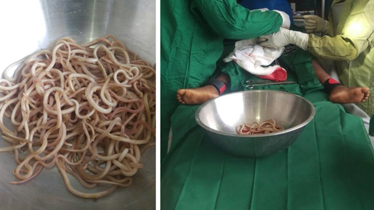 tapeworm in humans stomach