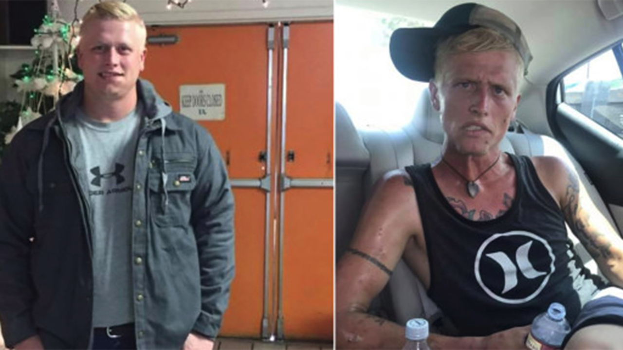 Meth Faces Before And After Telegraph