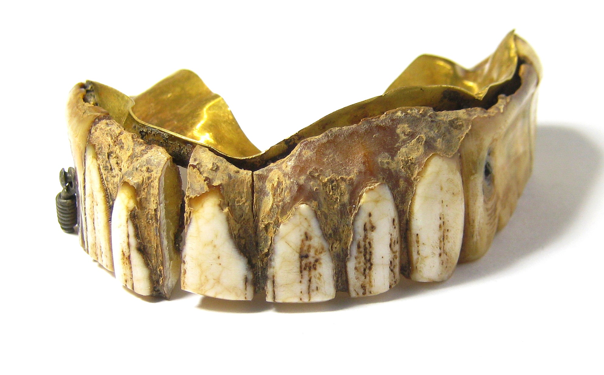 Зуб без кости. Зубные протезы древнего Рима. Пьер Фошар зубные протезы.