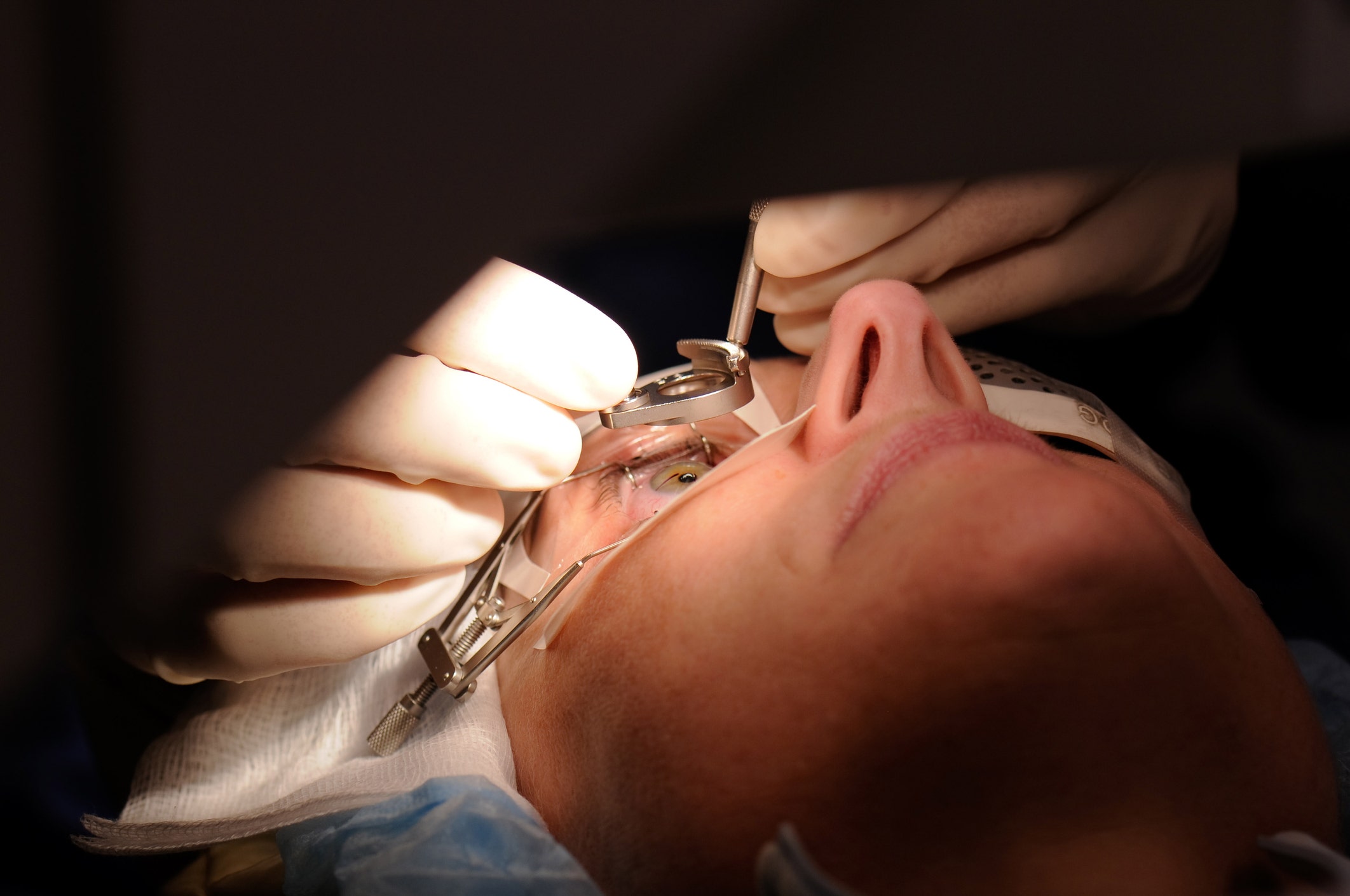 FDA warns that LASIK surgery patients need to be better informed of risks before eye procedure