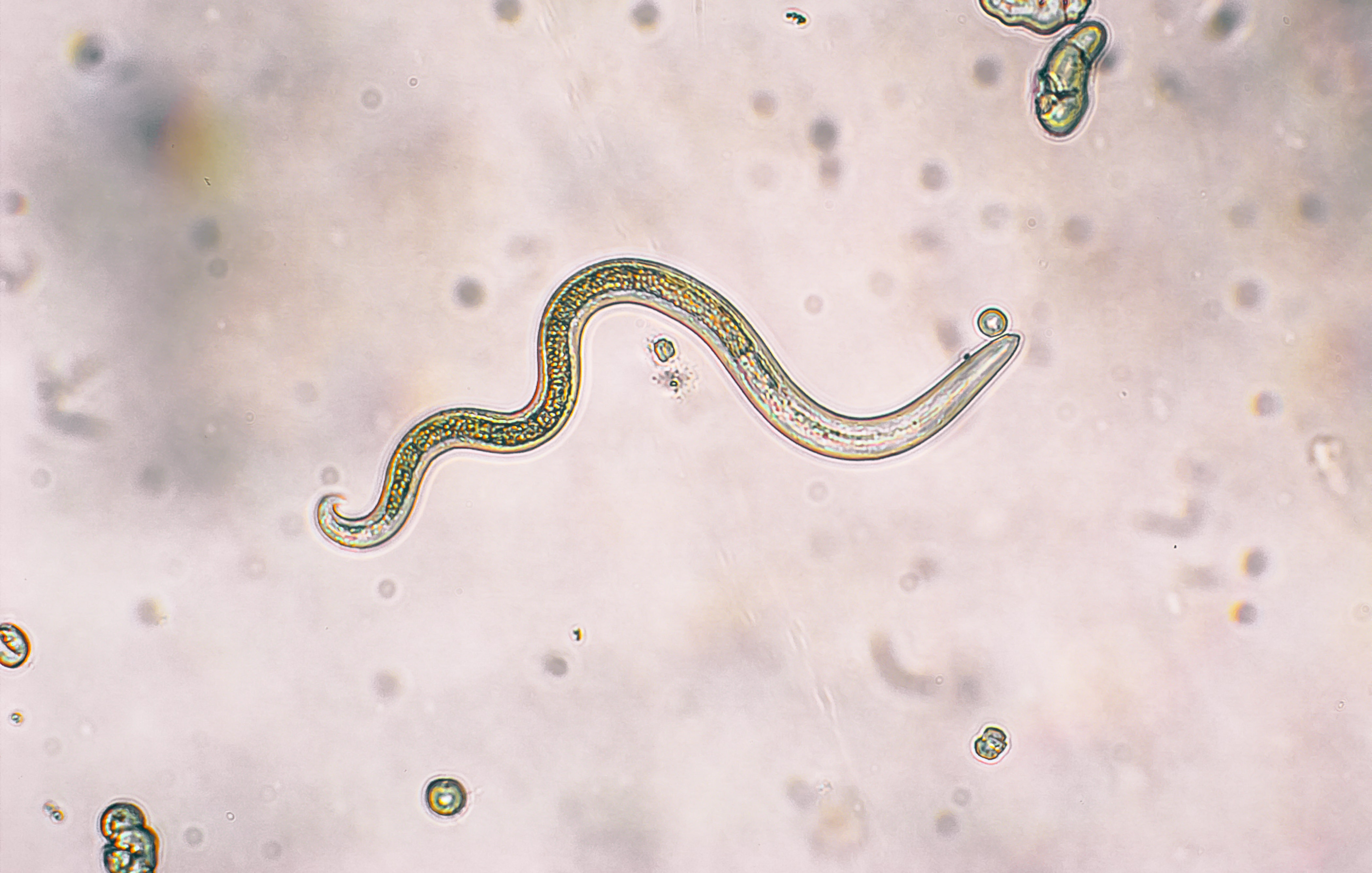 parasite worm in eye