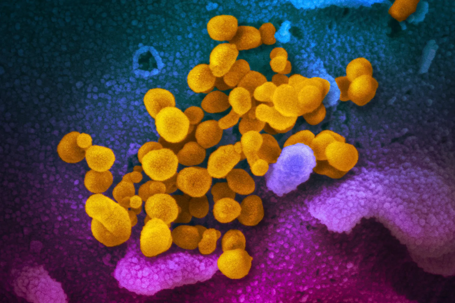 Coronavirus weakening, may disappear on its own, Italian doctor says
