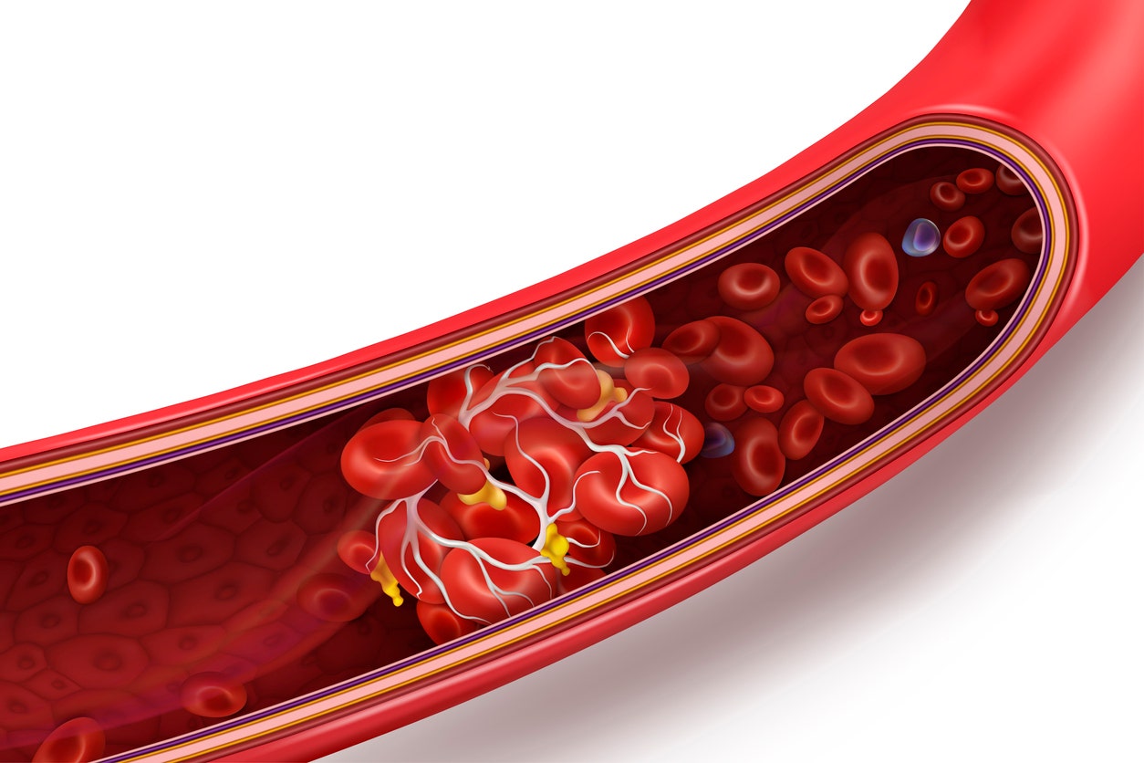 Researchers Find Autoantibodies Behind Coronavirus Blood Clotting Fox