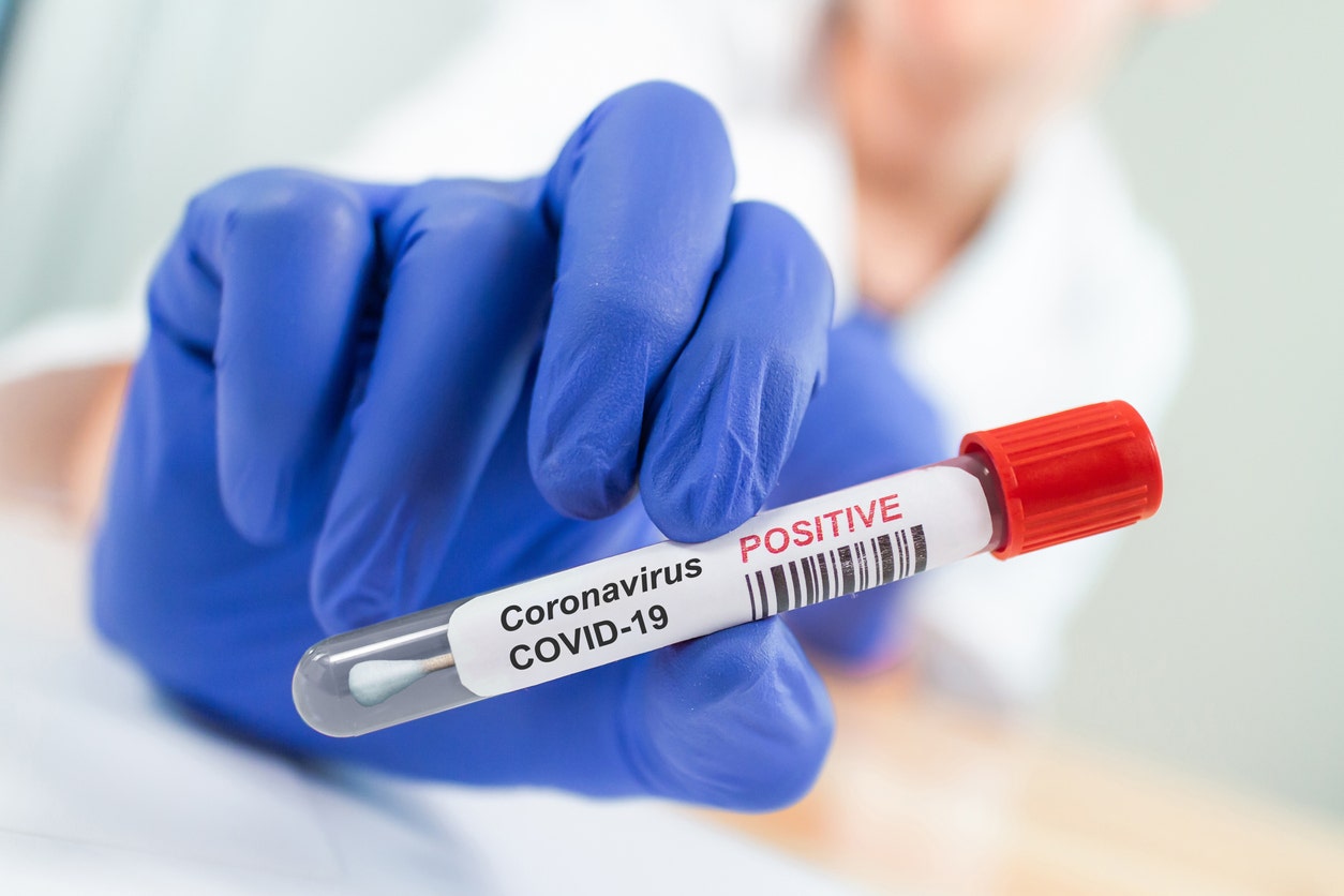 15 states see COVID cases rise as experts warn of potential resurgence