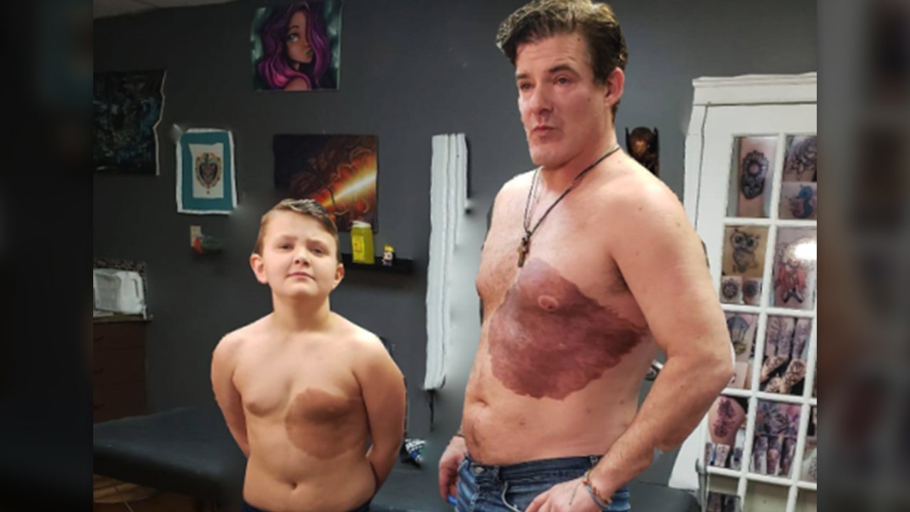 FOX NEWS: Dad gets huge tattoo identical to son’s birthmark on his chest