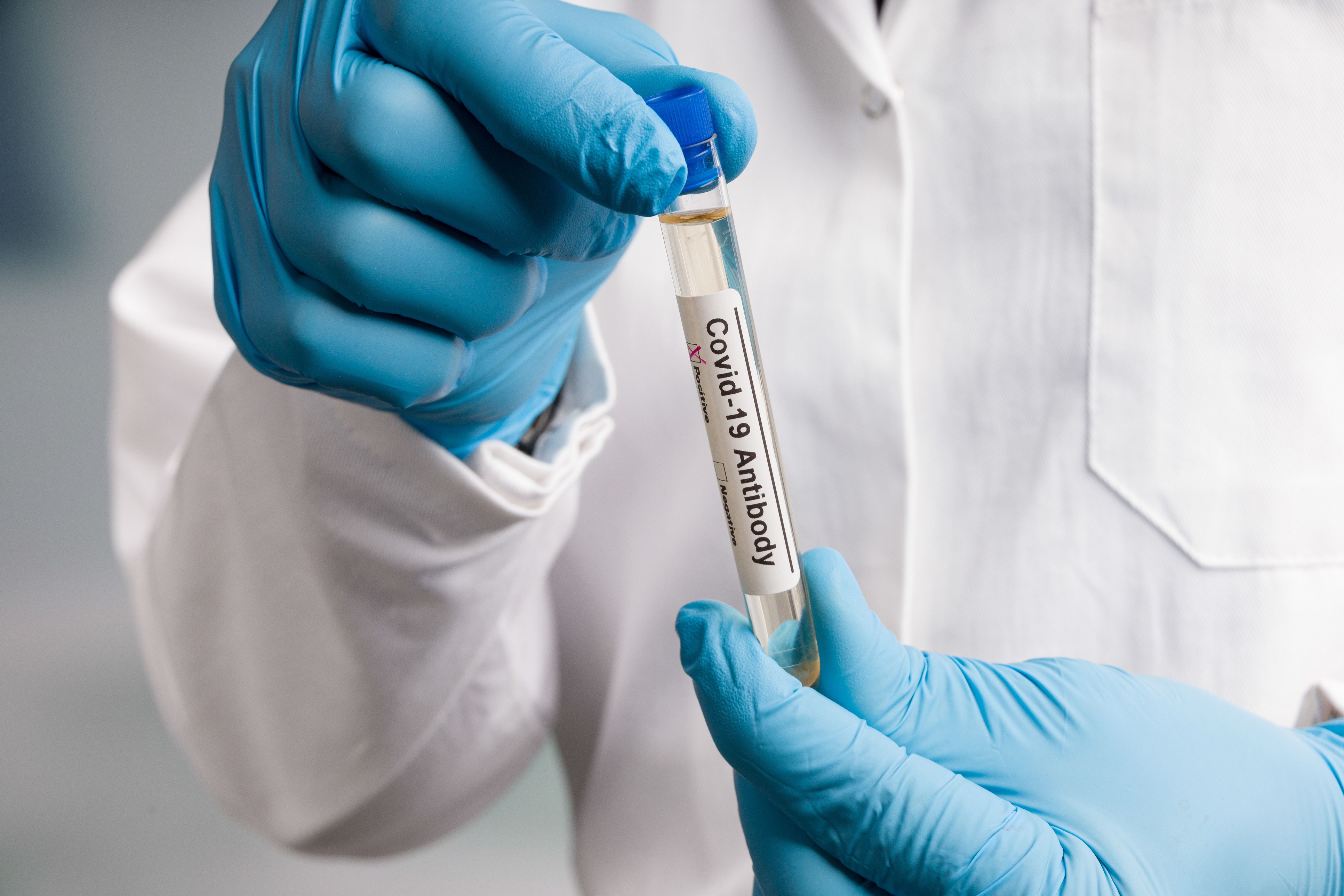 CDC ragina laboratorijas naudoti COVID testus, kurie gali atskirti gripą