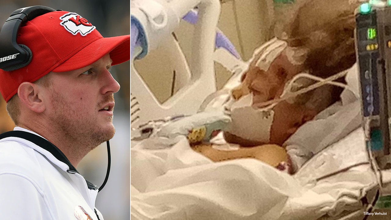 5-year-old girl seriously injured in Ex-Chiefs coach Britt Reid’s accident “still in a coma” says the family