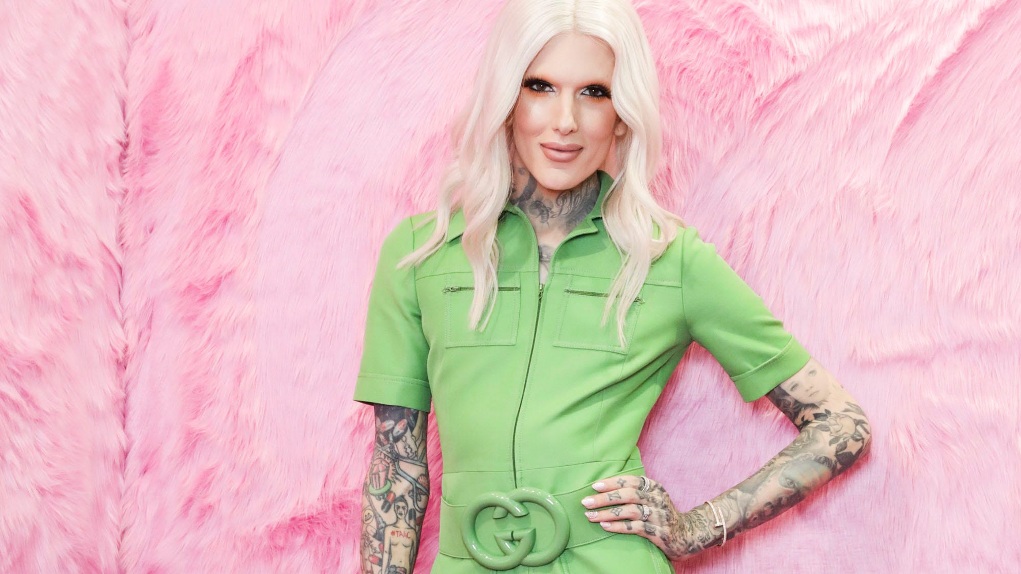Jeffree Star is in 'excruciating pain' following his car accident: 'Time to heal'
