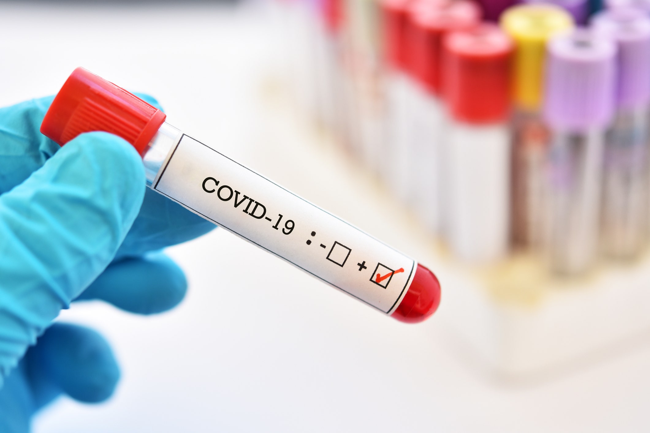 Alabama woman arrested for falsifying coronavirus test results in Virgin Islands