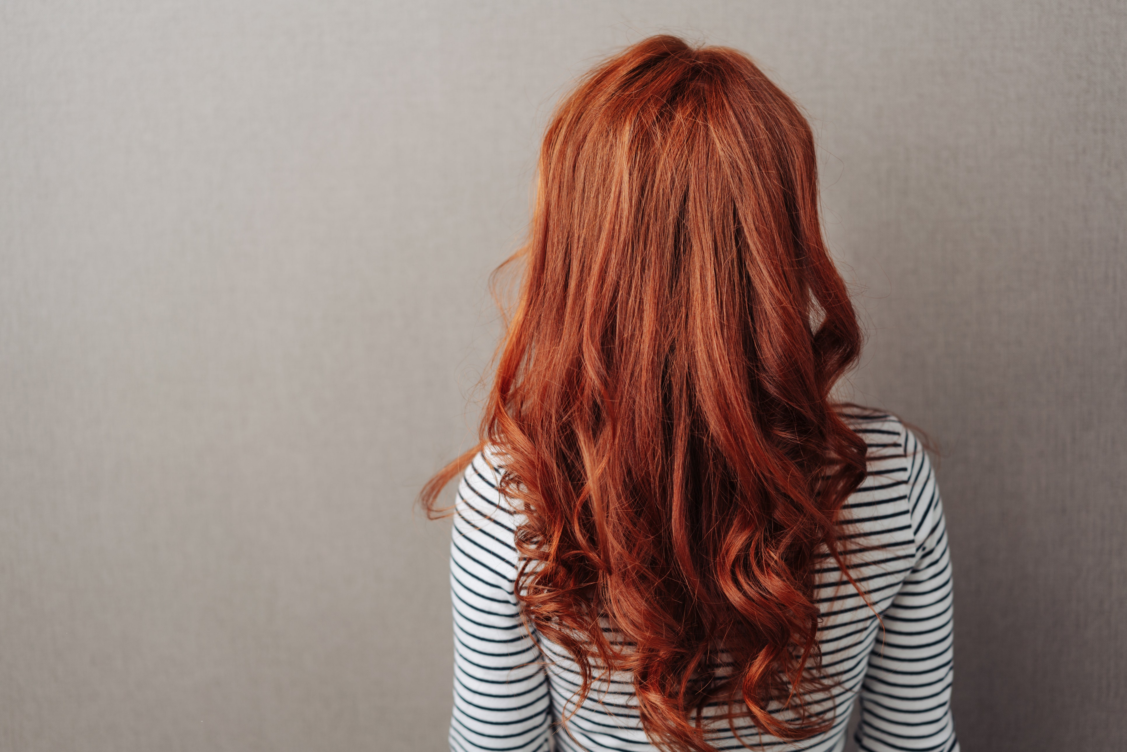 According to scientists, redheads feel less pain