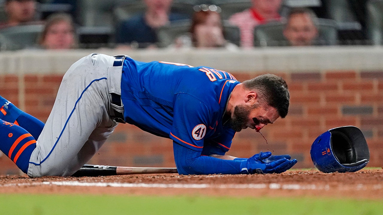Kevin Pillar hit in face injury: MLB must address HBPs - Sports Illustrated