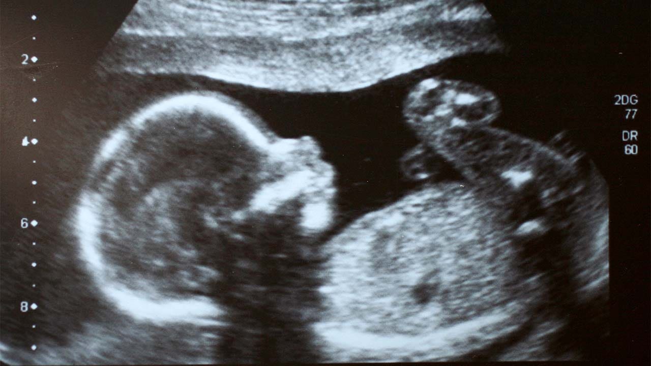 Pro-lifers push back as left-wing pundits question science on fetal heartbeats after Texas abortion ruling – Fox News