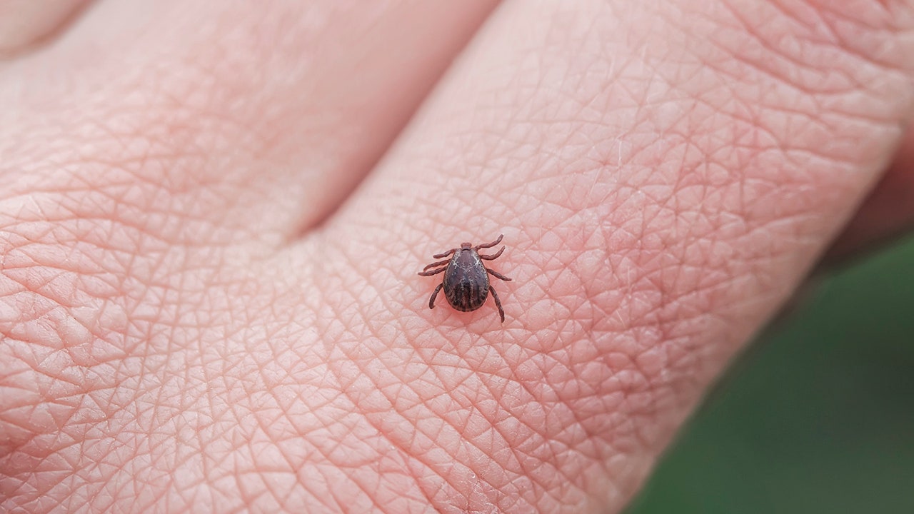 Tick bites on the rise: How to stay safe as you head outdoors