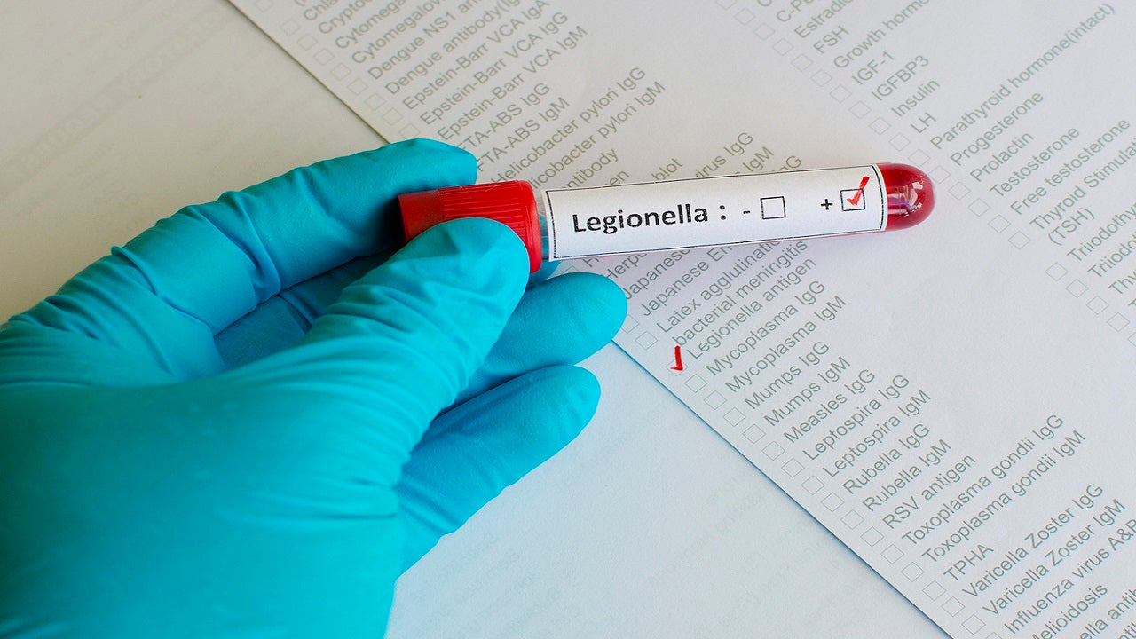 Michigan reports uptick in Legionnaires' disease