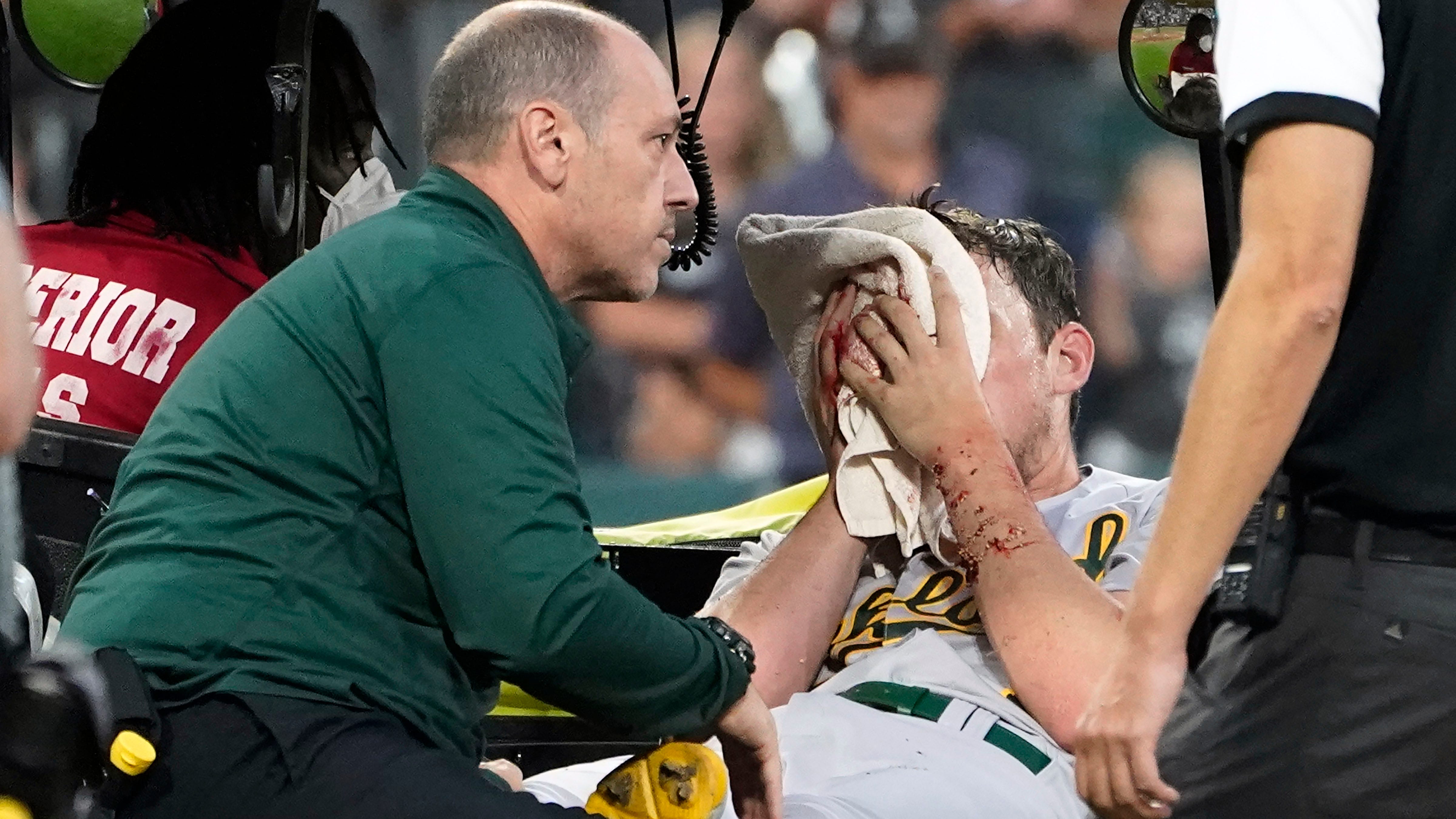 A's Chris Bassitt explains why he returned to mound after scary facial  injury: 'We are the green and gold